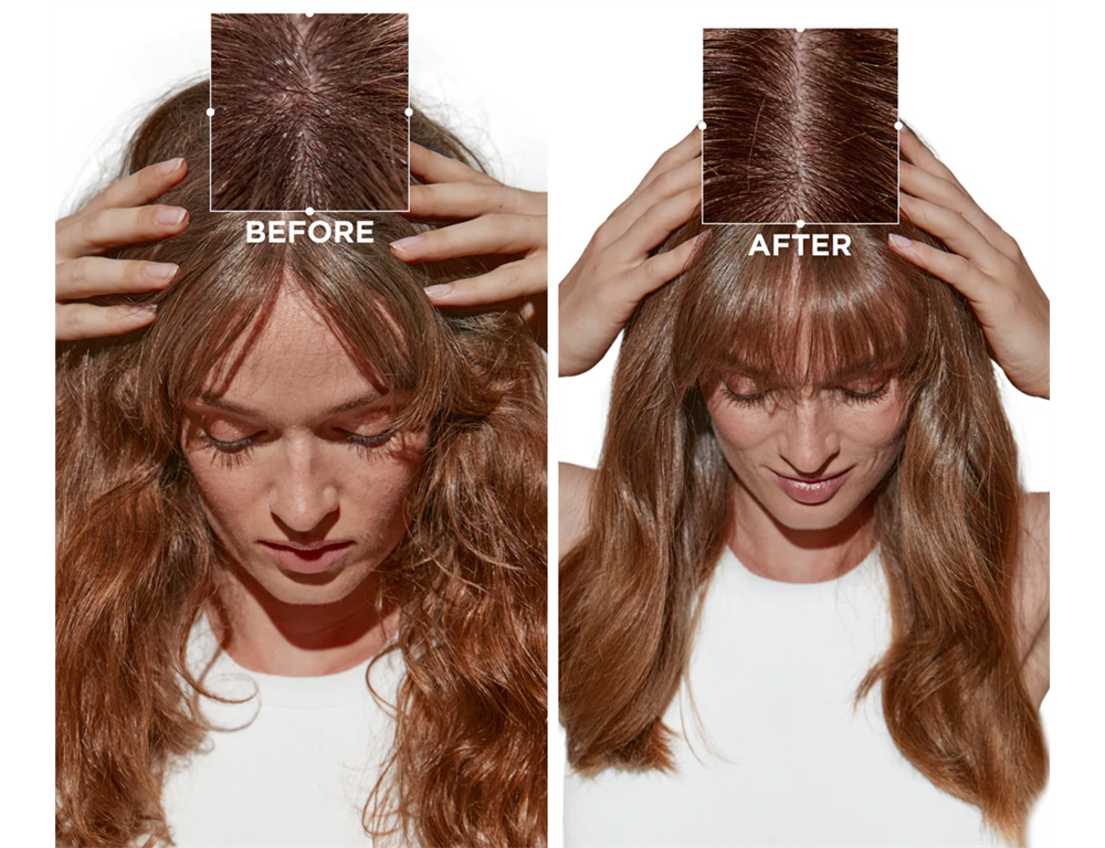 Symbiose Bain Pureté Anti-Pelliculaire